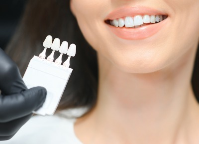Porcelain Veneers Treatment