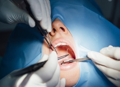 Oral and Maxillofacial Surgery